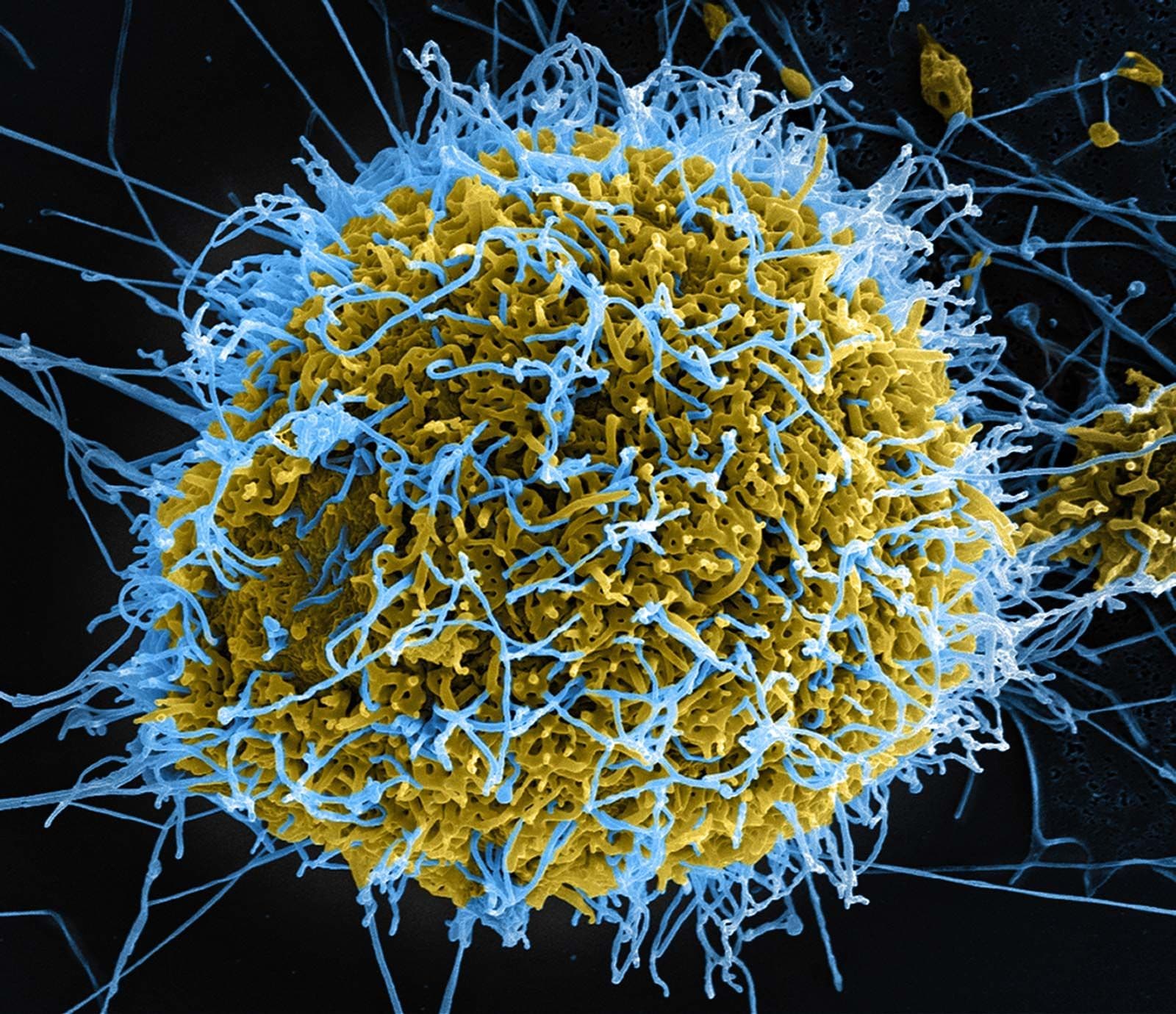 Polymarket event artwork: Ebola pandemic in 2026?